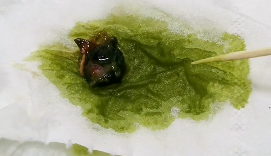 十大有毒快速致死食物（最容易中毒的十种食物） 第1张